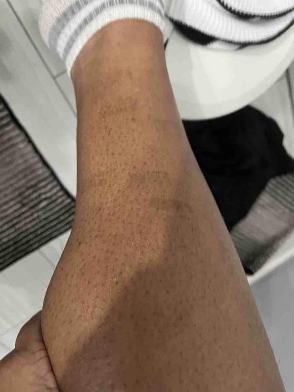 Review Thumbnail Image 0 239377107