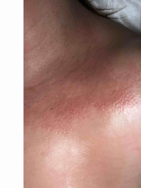 Customer photo for "allergy to this perfume"