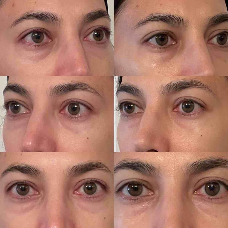 Review Thumbnail Image 0 219097883