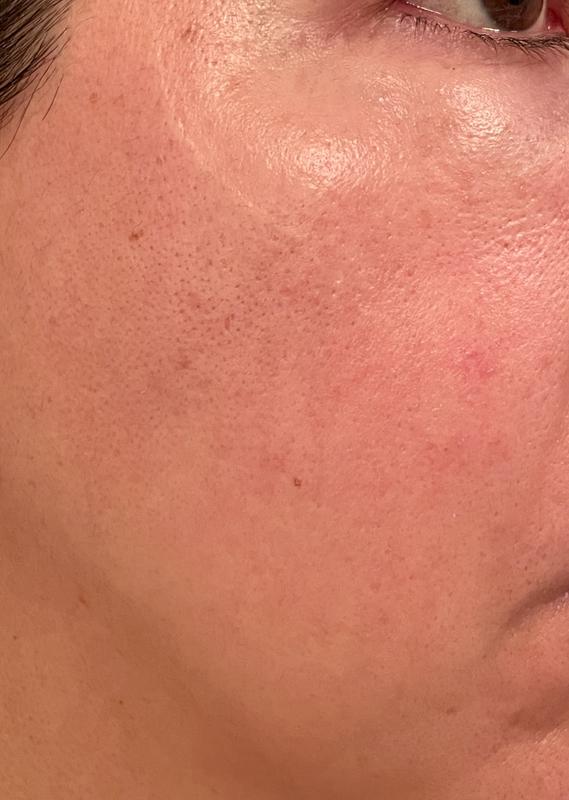 Customer photo for "Glowy finish, but no major results after 30 days"