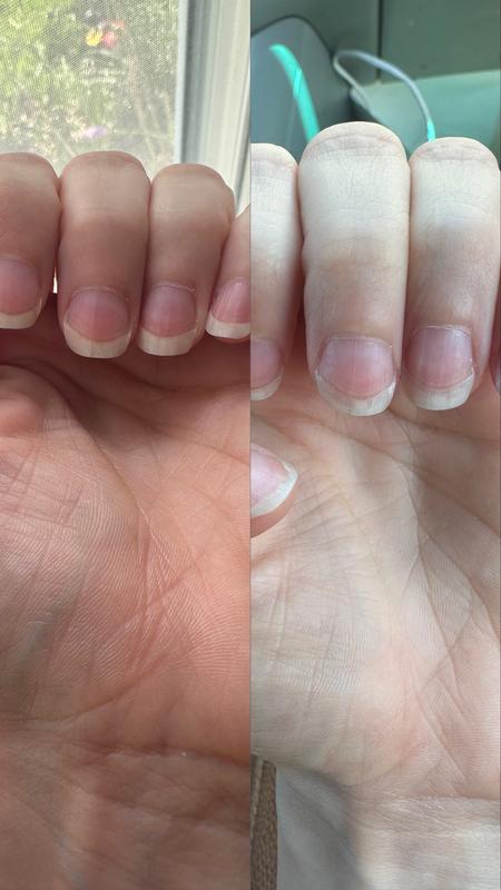 Customer photo for "Effective but oily"