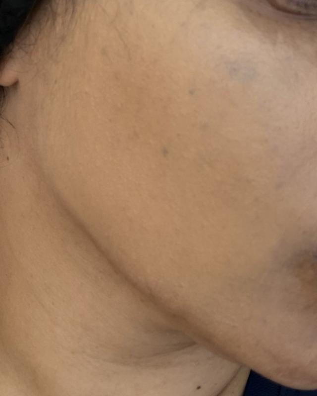 Review Thumbnail Image 0 249750204