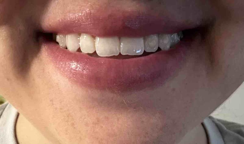 Review Thumbnail Image 0 243518675