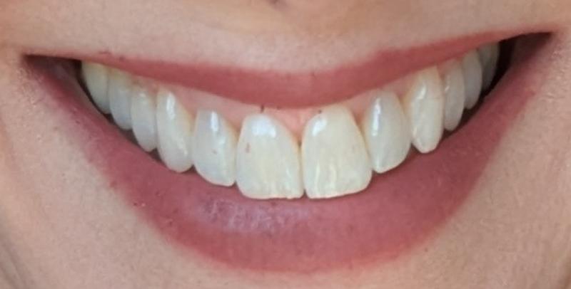 Customer photo for "Autumn Delight!"