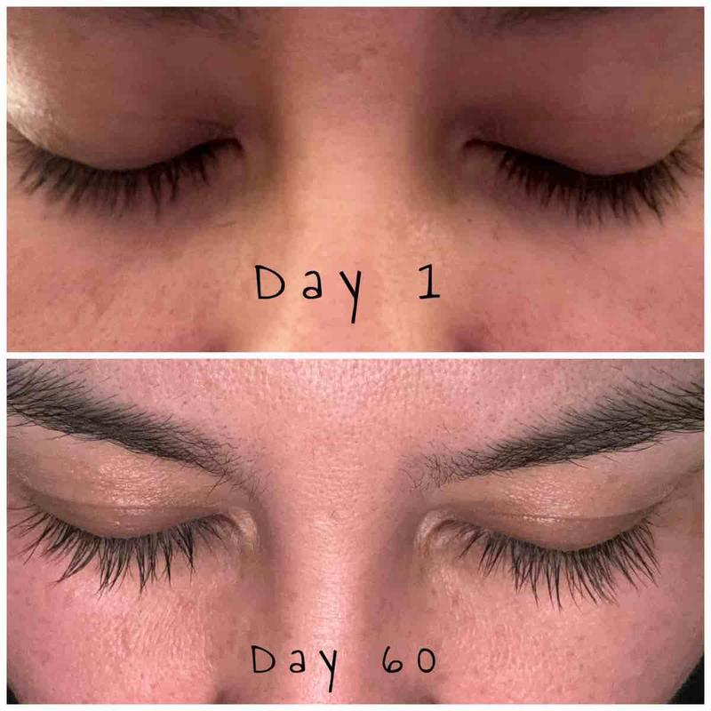 Customer photo for "Results are real!"
