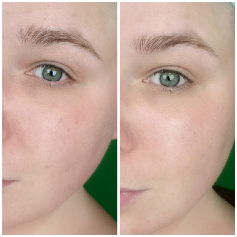 Customer photo for "Great results, glowing skin!"