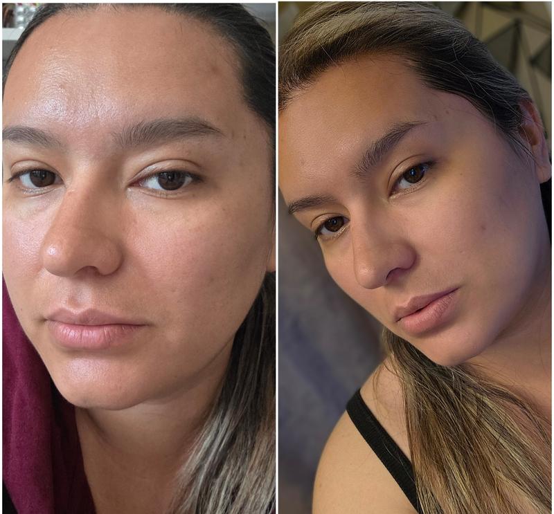 Customer photo for "In love this serum"