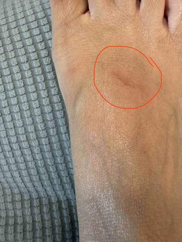 Customer photo for "Painful buckle"