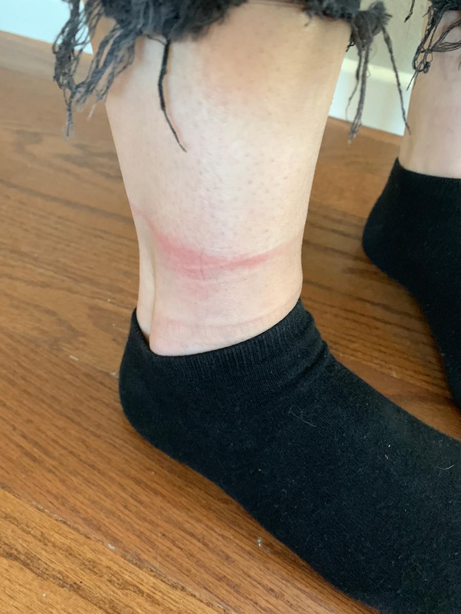 Customer photo for "Left scab cuts on my legs"