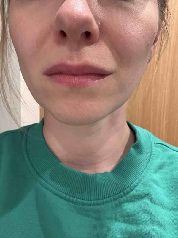 Customer photo for "natural beauty and moisturizing"