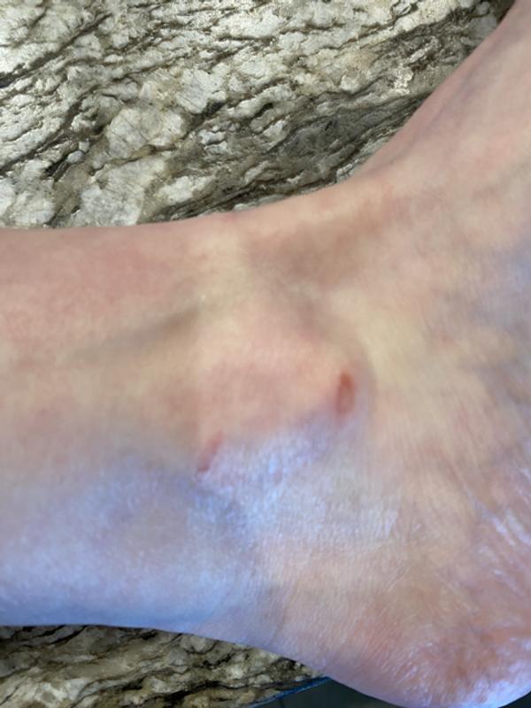 Customer photo for "Hurts on the ankle"