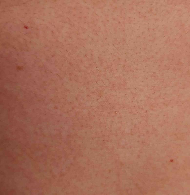 Review Thumbnail Image 2 218997061