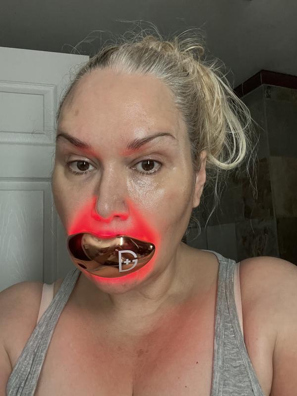 Customer photo for "BETTER THAN BOTOX"
