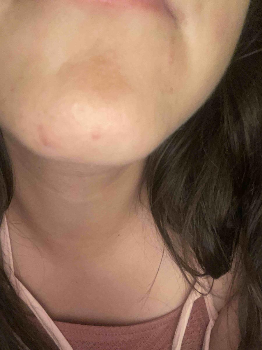 Review Thumbnail Image 0 209638231