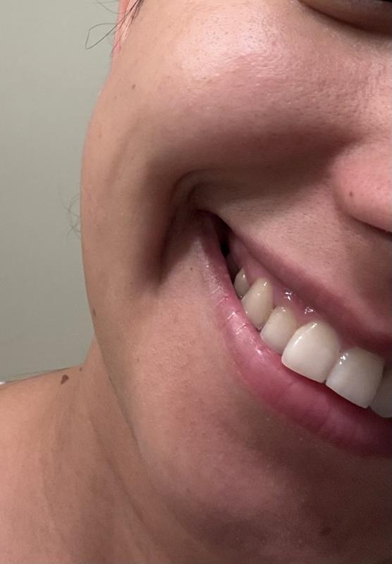Customer photo for "Amazing skincare porduct"