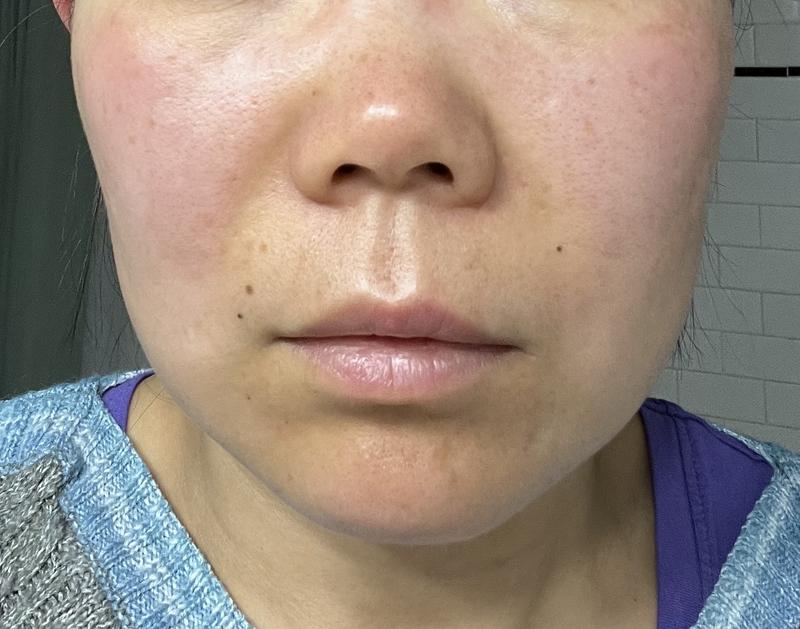 Customer photo for "Allergy reaction"
