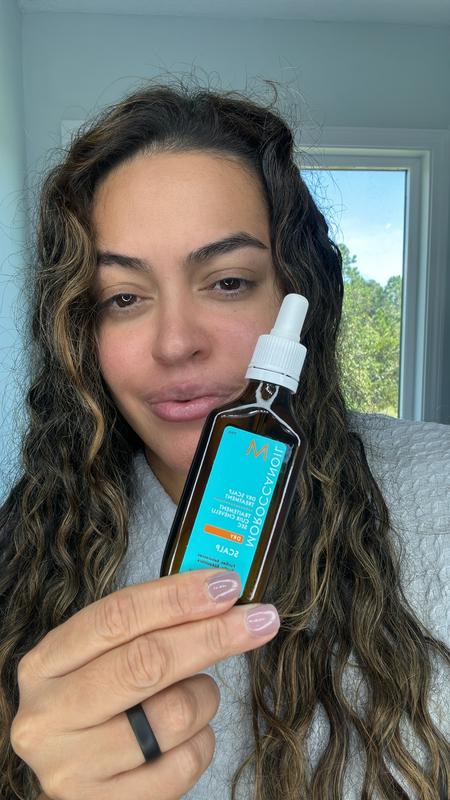 Customer photo for "Game-Changer for Dry, Flaky Scalps!"