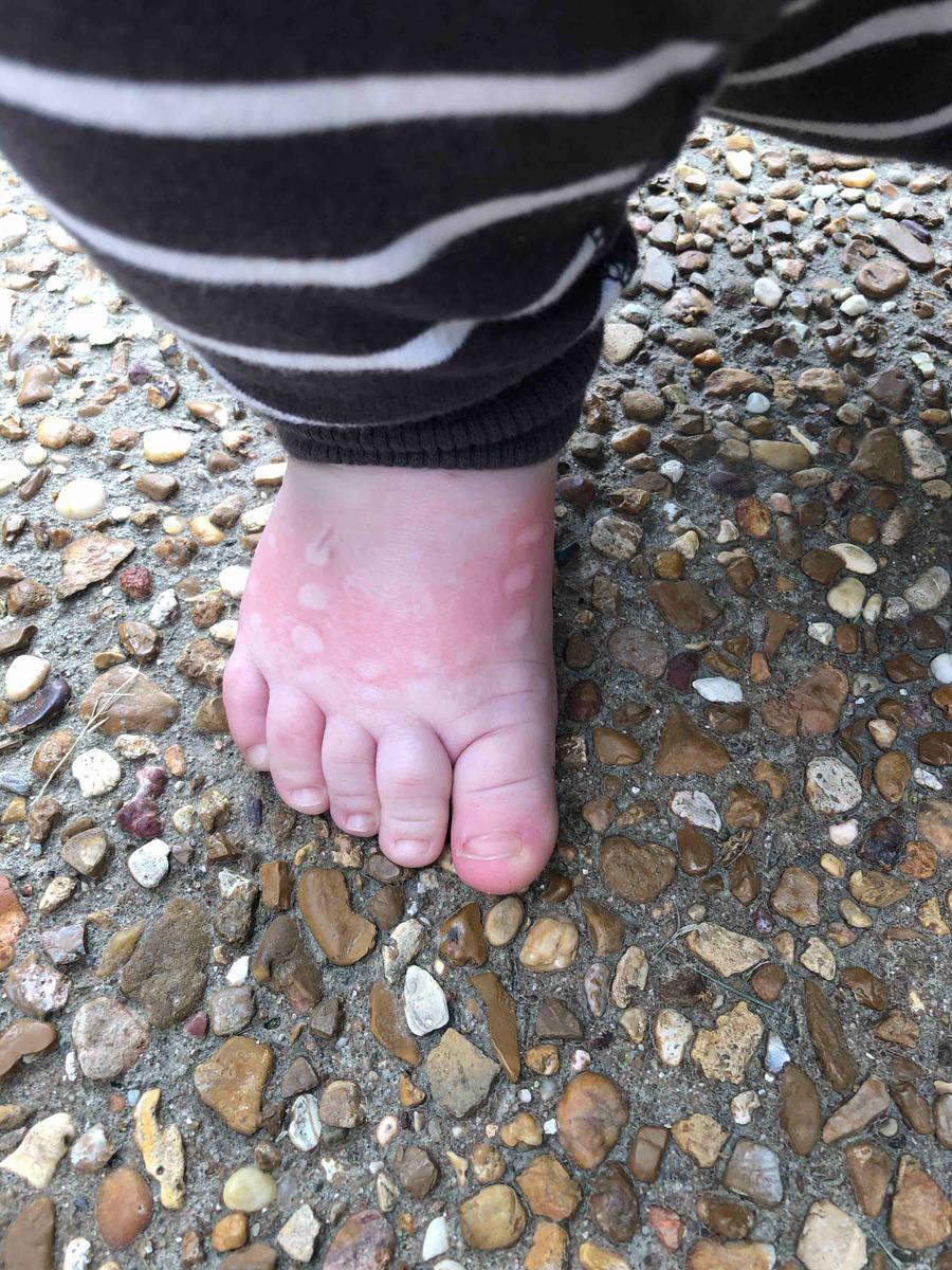 NOT for chubby little feet!