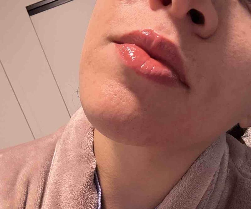 Customer review photo