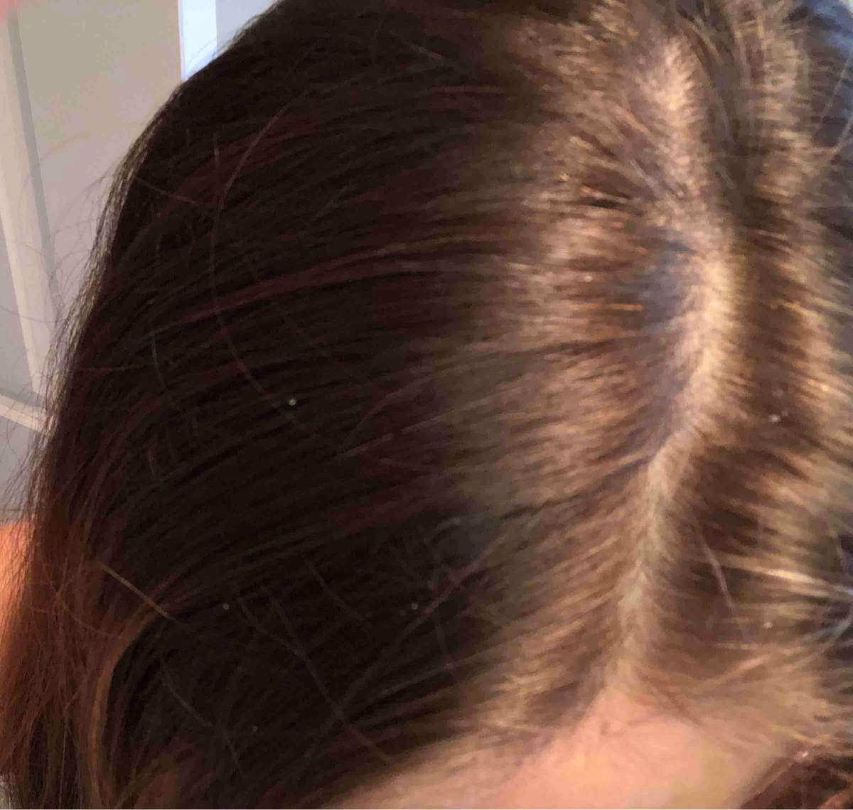 Review Thumbnail Image 1 197643495