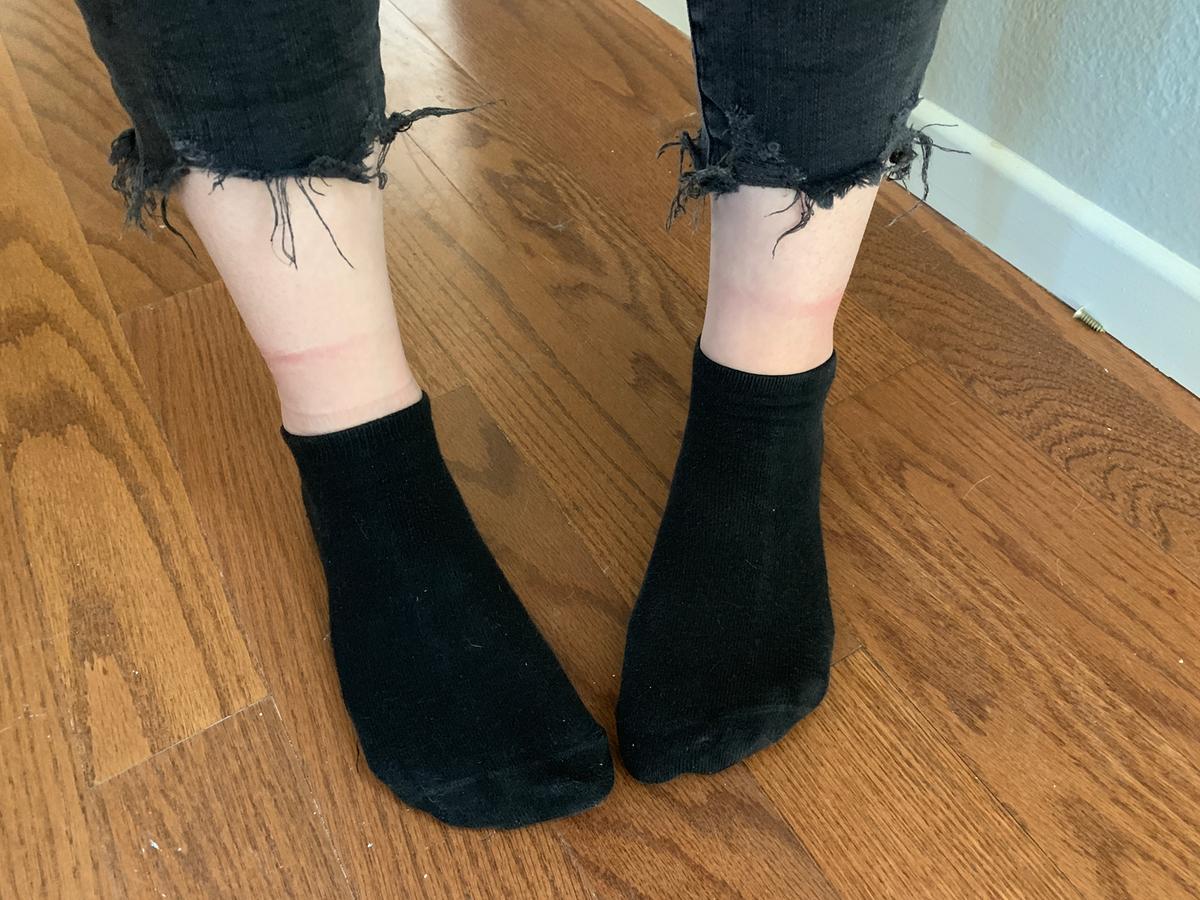 Customer photo for "Left scab cuts on my legs"