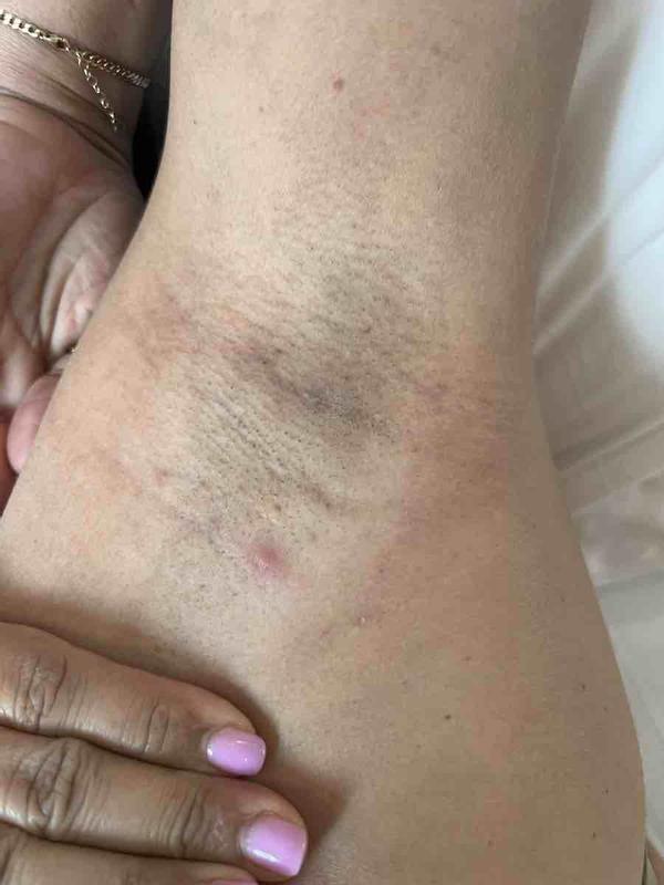 Review Thumbnail Image 0 227653551