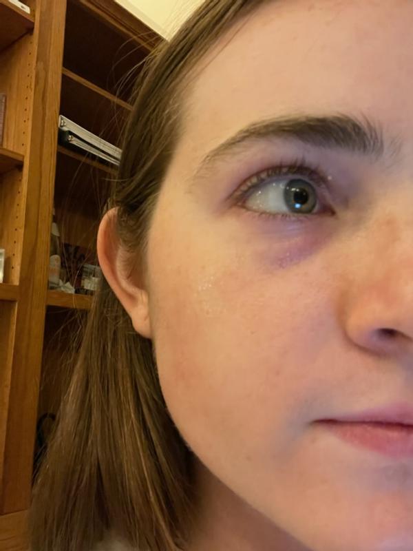 Customer photo for "Pores Be Gone! Fav Dr. Barbara Sturm Product!"