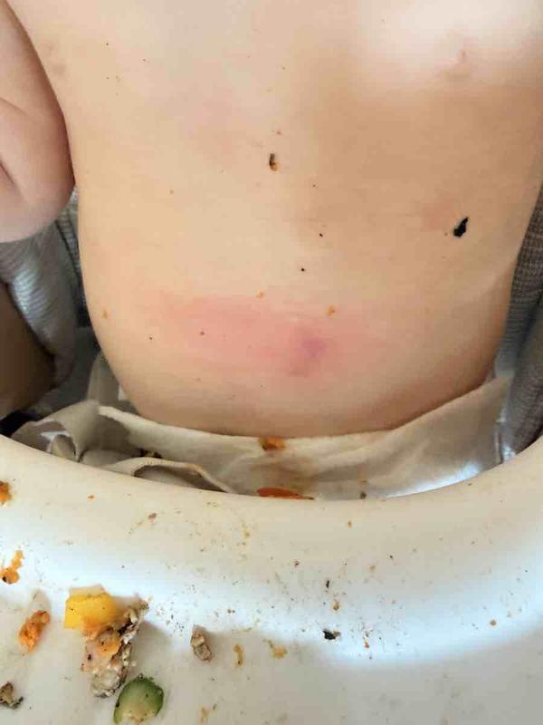 Customer photo for "Dangerous Design Flaw Do Not Buy"