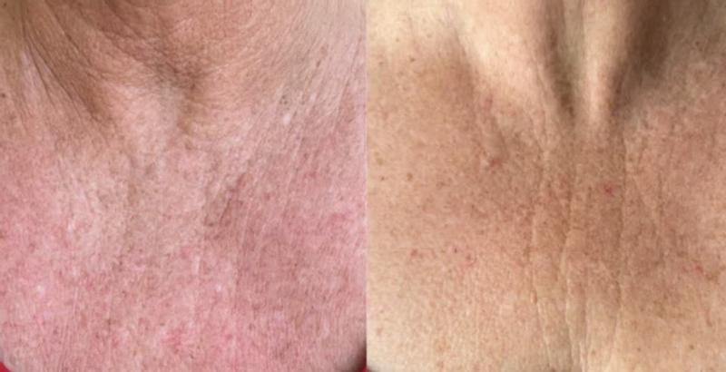 Review Thumbnail Image 0 243952076