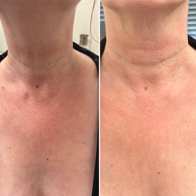 Review Thumbnail Image 0 245360295