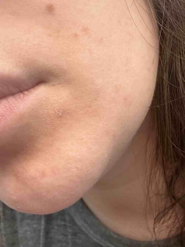 Review Thumbnail Image 0 222650581