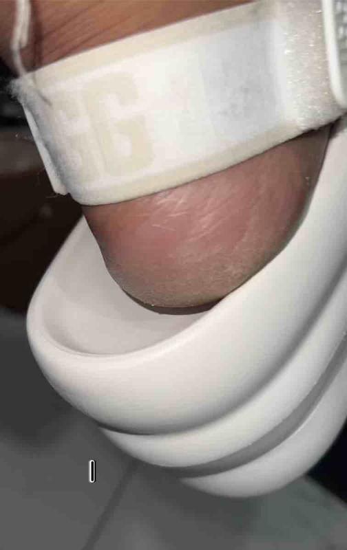 Customer photo for "transforms my heels and works to repair over time"