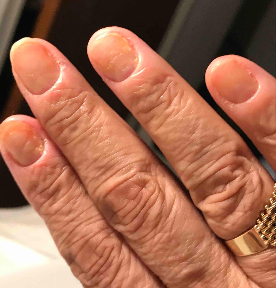 Review Thumbnail Image 0 197369844