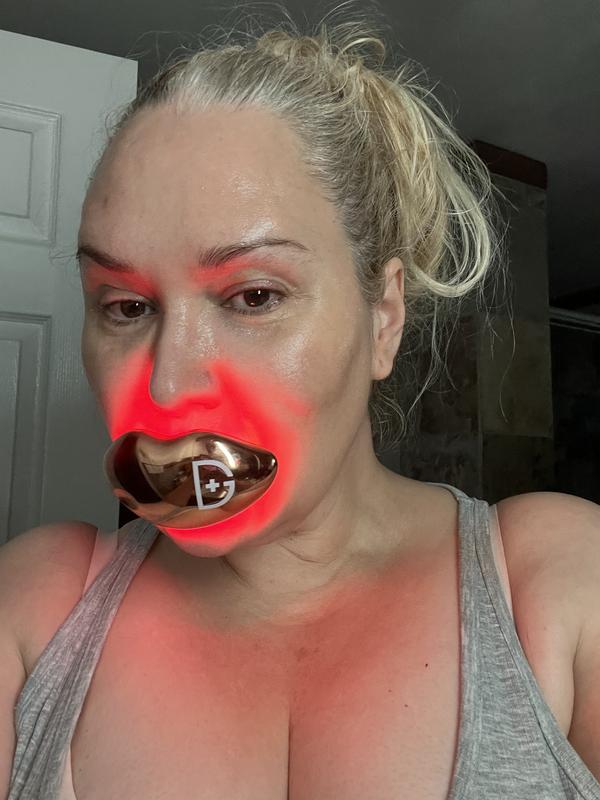 Customer photo for "BETTER THAN BOTOX"