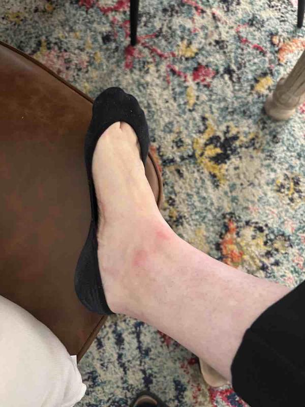 Customer photo for "The Worst."