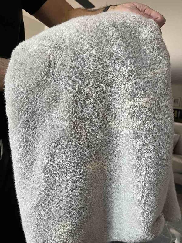 Customer photo for "the worst discoloration"