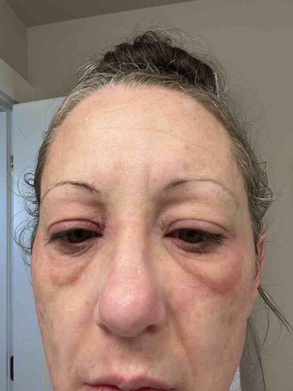 Customer photo for "Ouch!!"