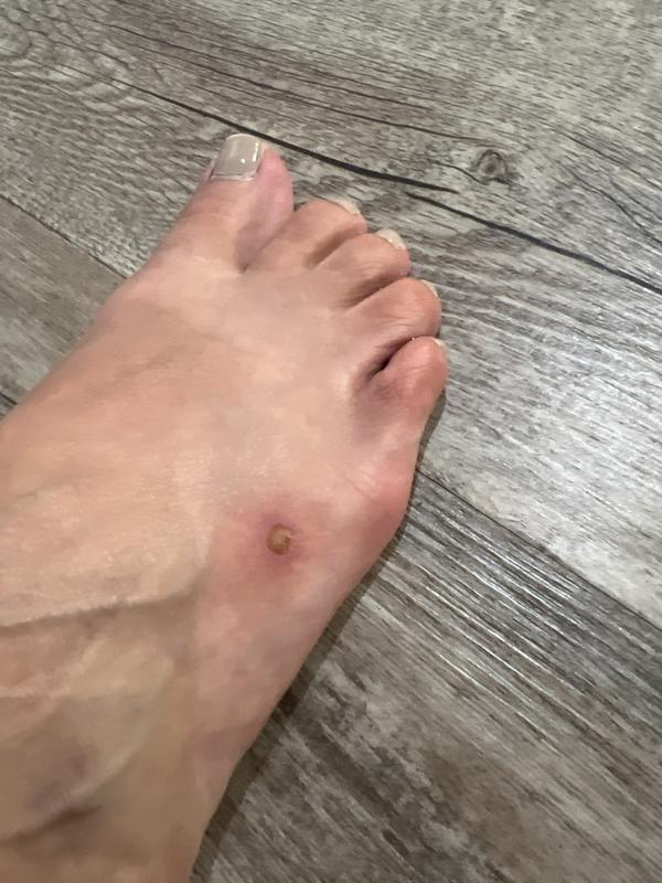 Customer photo for "Braided Leather Flip Flops-Uncomfortable"