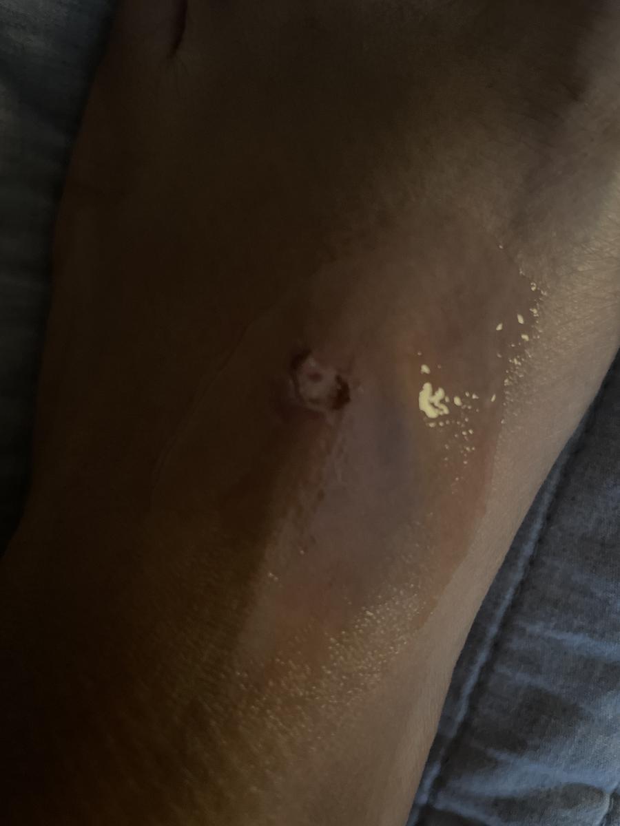 Review Thumbnail Image 0 204045508