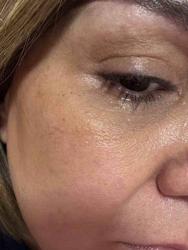 Customer photo for "burns eyes"