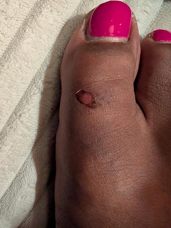 Review Thumbnail Image 0 251660236