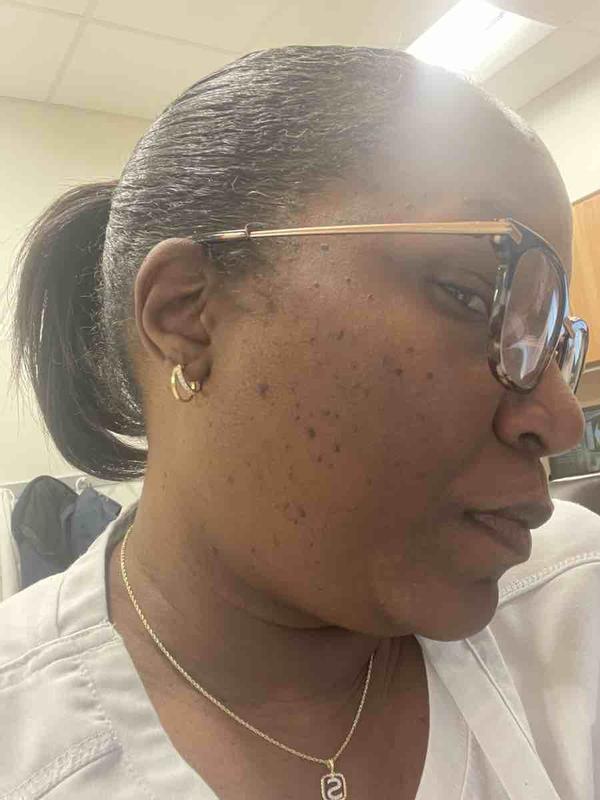 Review Thumbnail Image 2 238999899