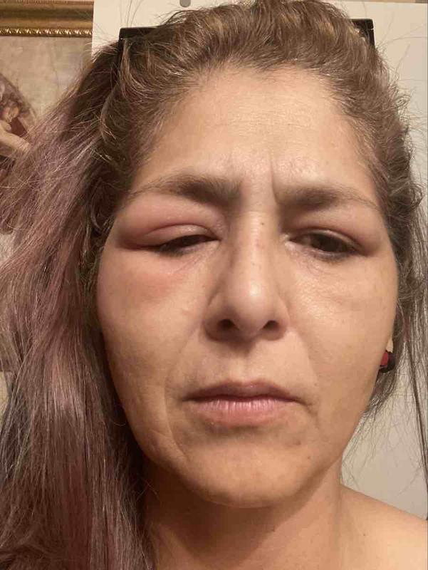 Customer photo for "Worst Experience"