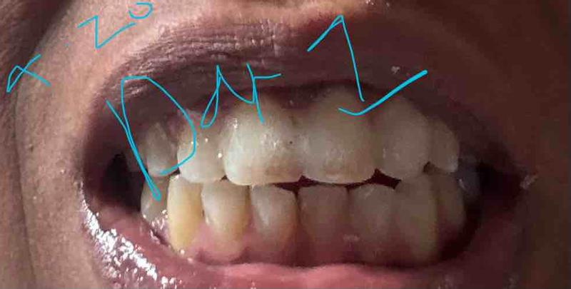 Review Thumbnail Image 0 243472213