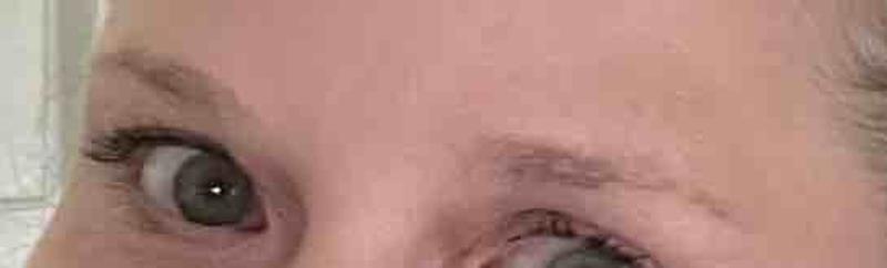 Customer photo for "surprising results"