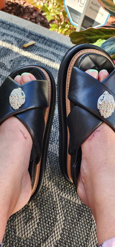 Customer photo for "Blisters on both feet"