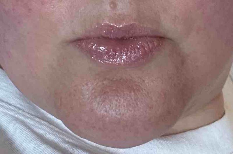 Review Thumbnail Image 0 232652342