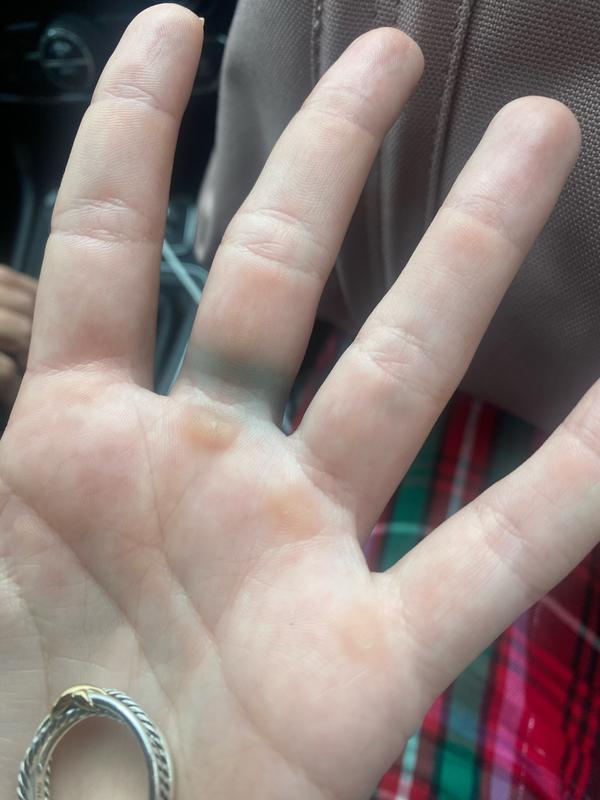 Customer photo for "Turned finger green"
