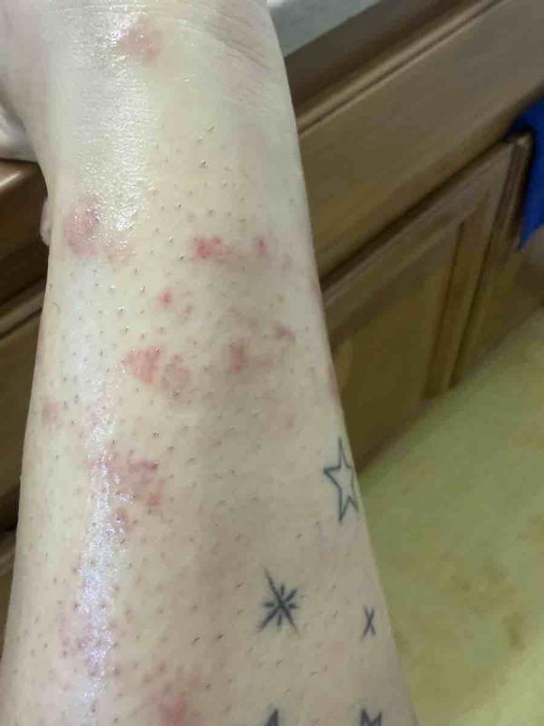 Customer review photo