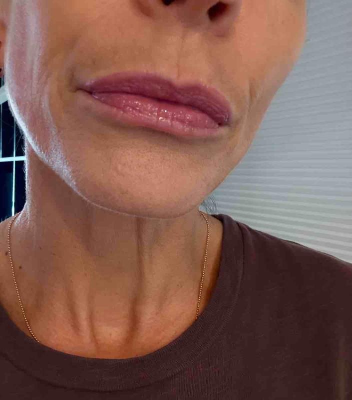 Review Thumbnail Image 0 247384197